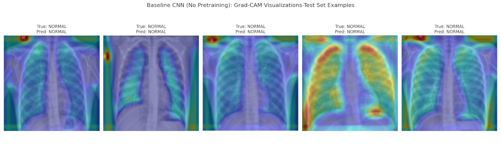 A series of pictures of lungs, with different regions highlighted.